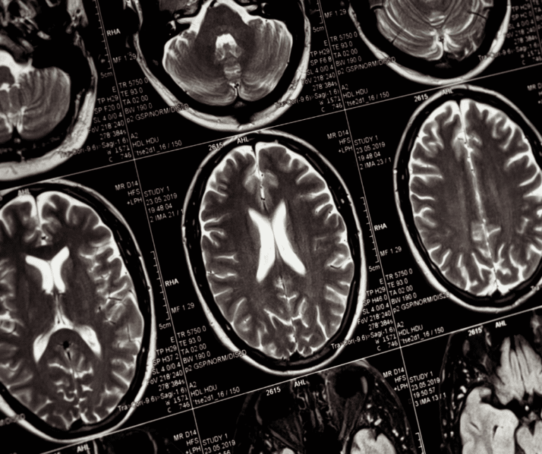 Derivative Calculator intelligence overview