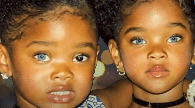 Remember The Most Beautiful Black Twins In The World This Is What Happened To Them 7740